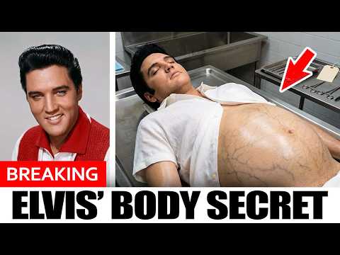 What Made Elvis Presley's Organs Grow to TWICE Their Size – His Final 24 Hours Will TERRIFY You!